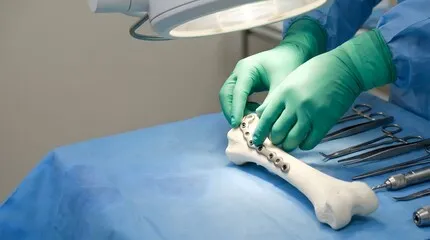 Surgeon placing a premium stainless steel bone plate implant on an artificial bone model with orthopedic surgical instruments on a sterile blue tray